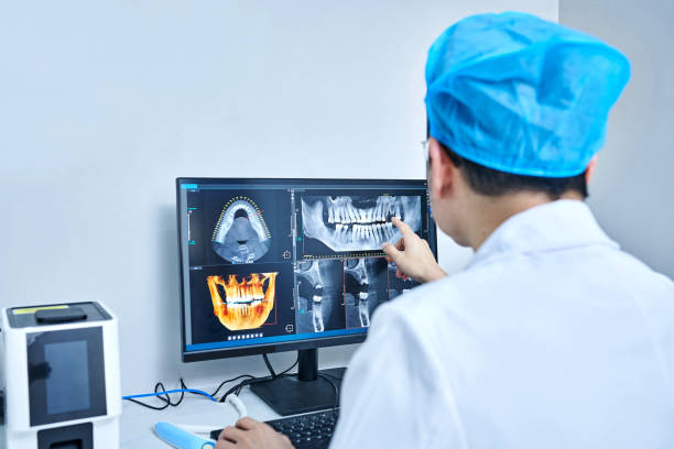 Best Emergency Wisdom Teeth Removal in Loudon, TN